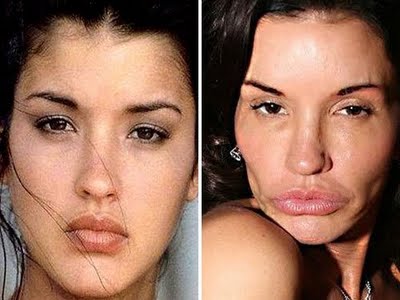 Janice-Dickinson-Before-After-Plastic-Surgery.jpg